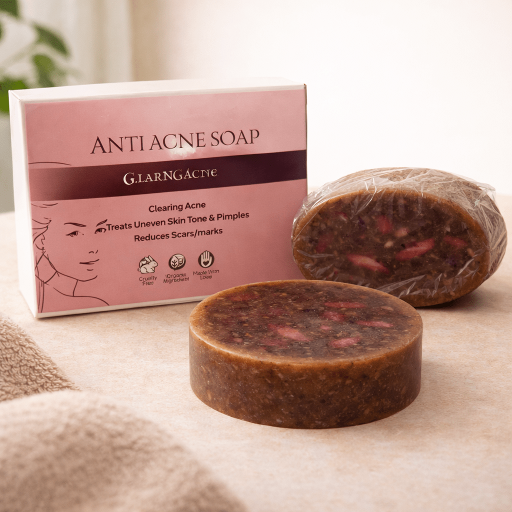 Anti Acne Soap | Aloeveda | Clearing Acne Treats Uneven Skin Tone and Pimples Reduces Scares | 100 Gm - TIRTHAS